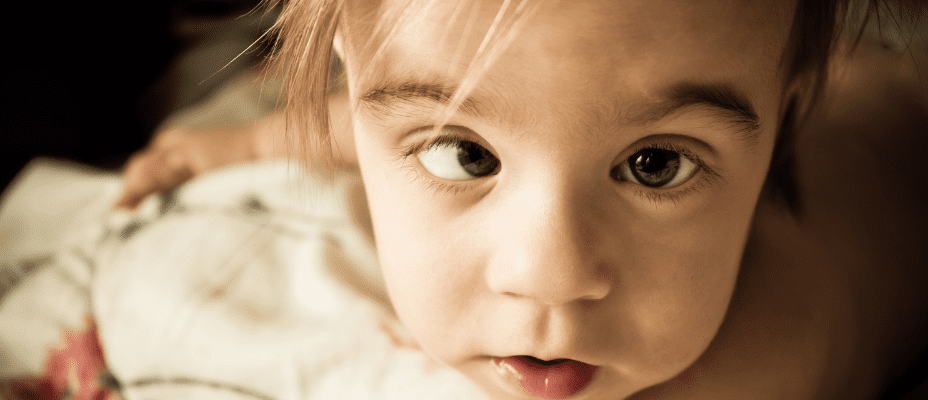 Lo strabismo nei bambini: come correggerlo con successo